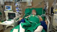 ICU patient
