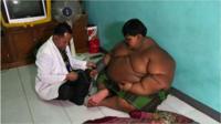 Menino obeso