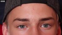 Malachi Neat's eyes