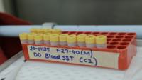 Flacons des vaccins potentiels contre les coronavirus