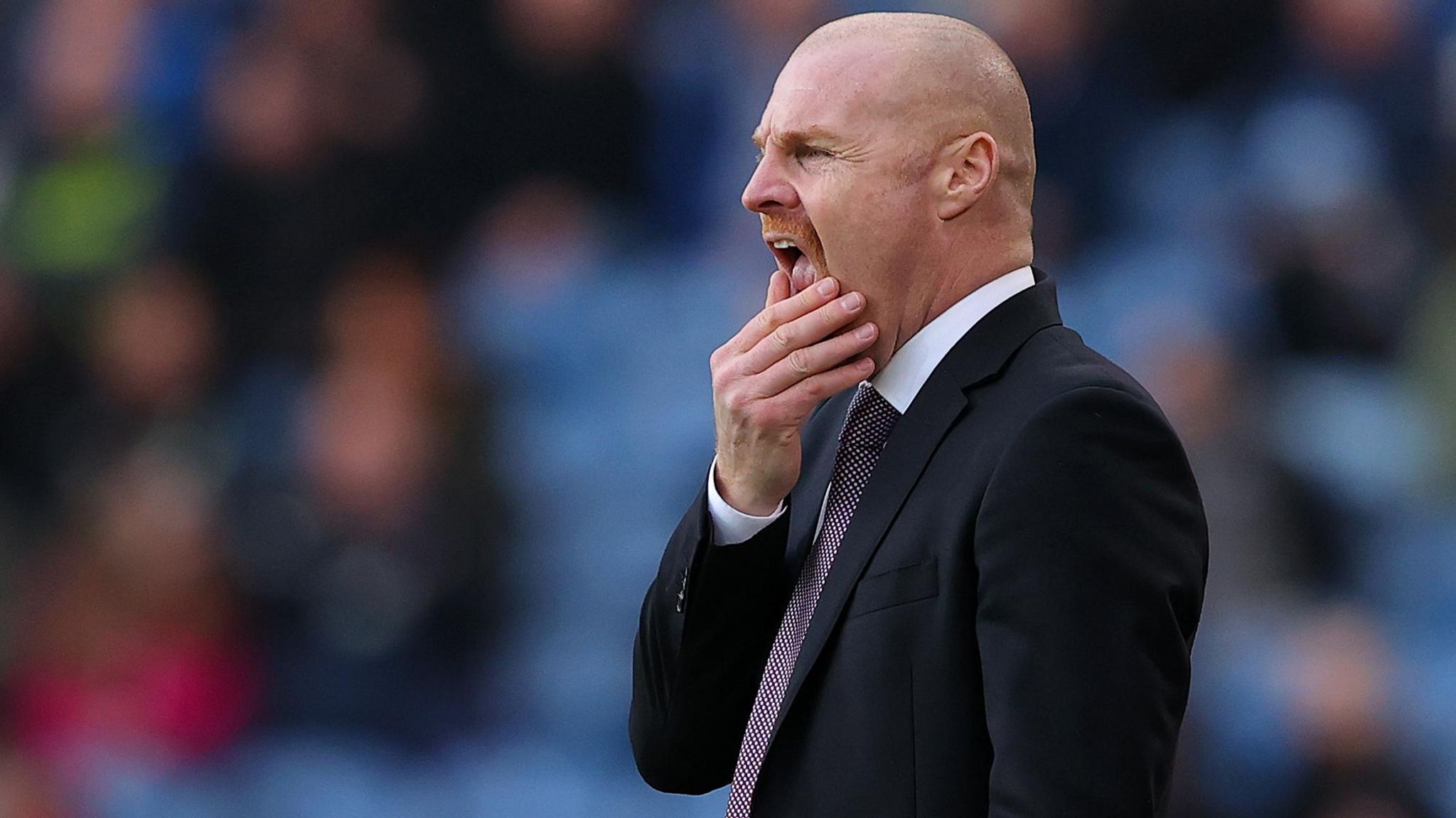 Player welfare 'off the scale' - Dyche - BBC Sport