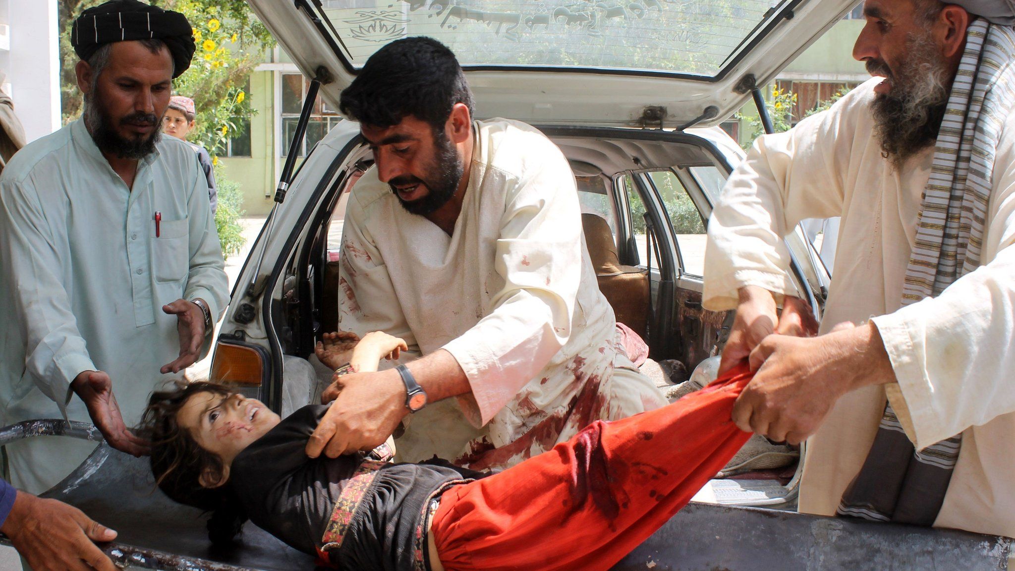 A wounded Afghan child being brought to a hospital after being injured in a mortar explosion in Kandahar on 1 July 2015