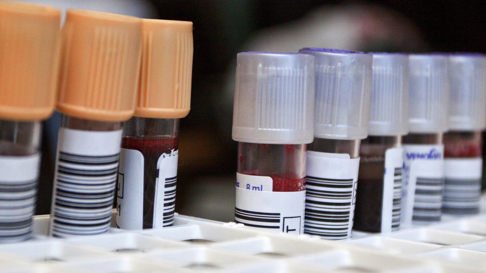 Blood samples