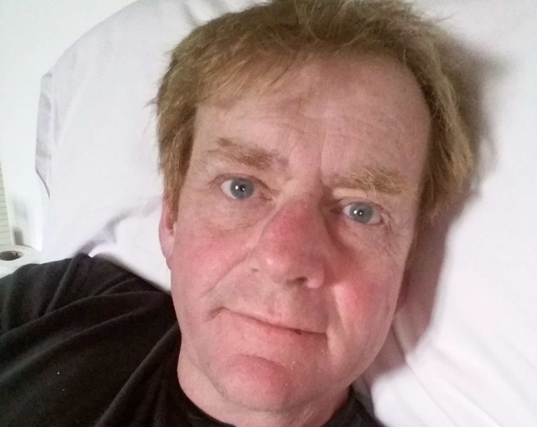 Arddangosfa gyntaf artist sydd â chanser terfynol - BBC Cymru Fyw