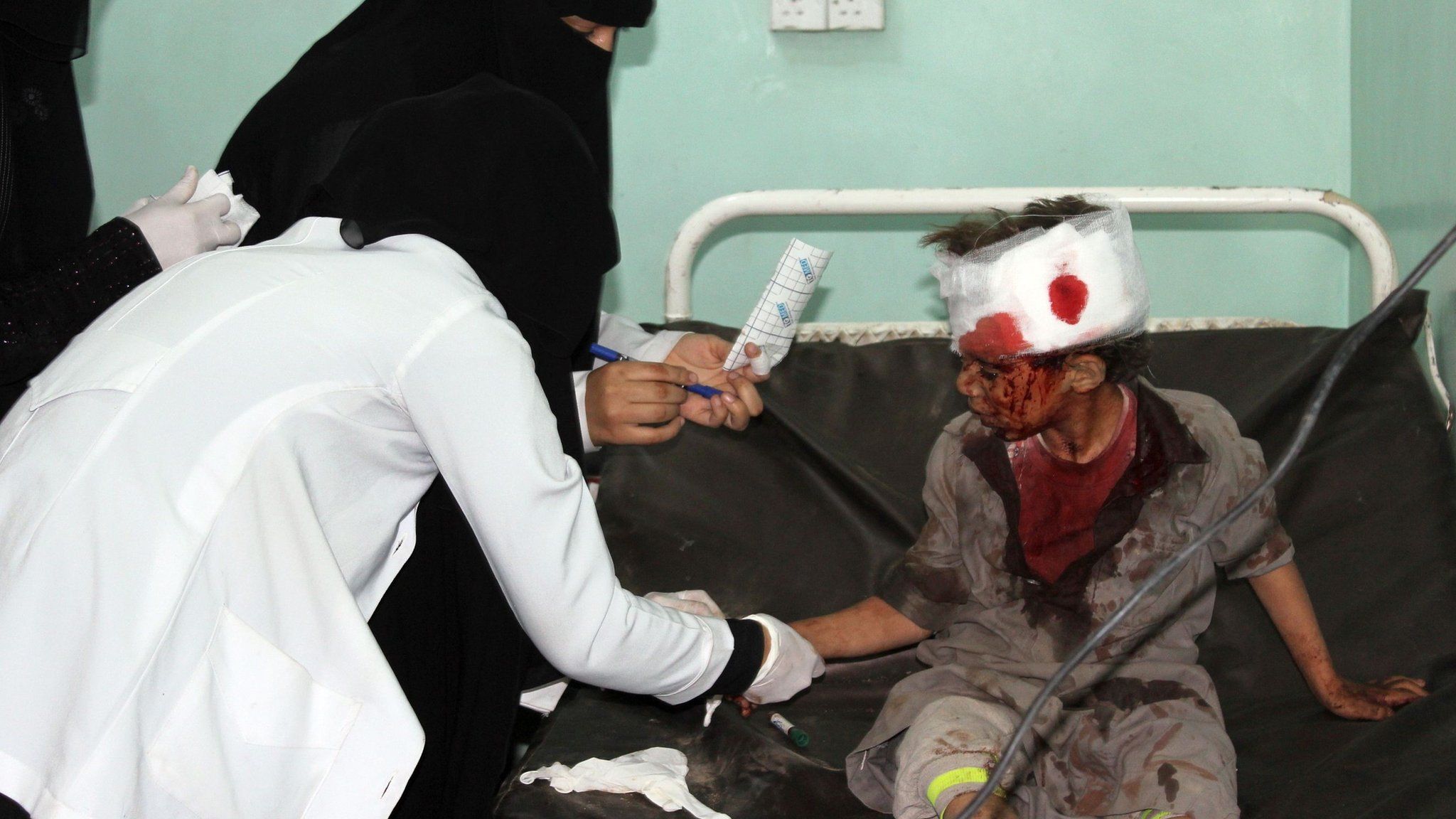 A Yemeni boy receives treatment at a hospital following a Saudi-led coalition air strike on a bus in Dahyan, Saada province, on 9 August 2018