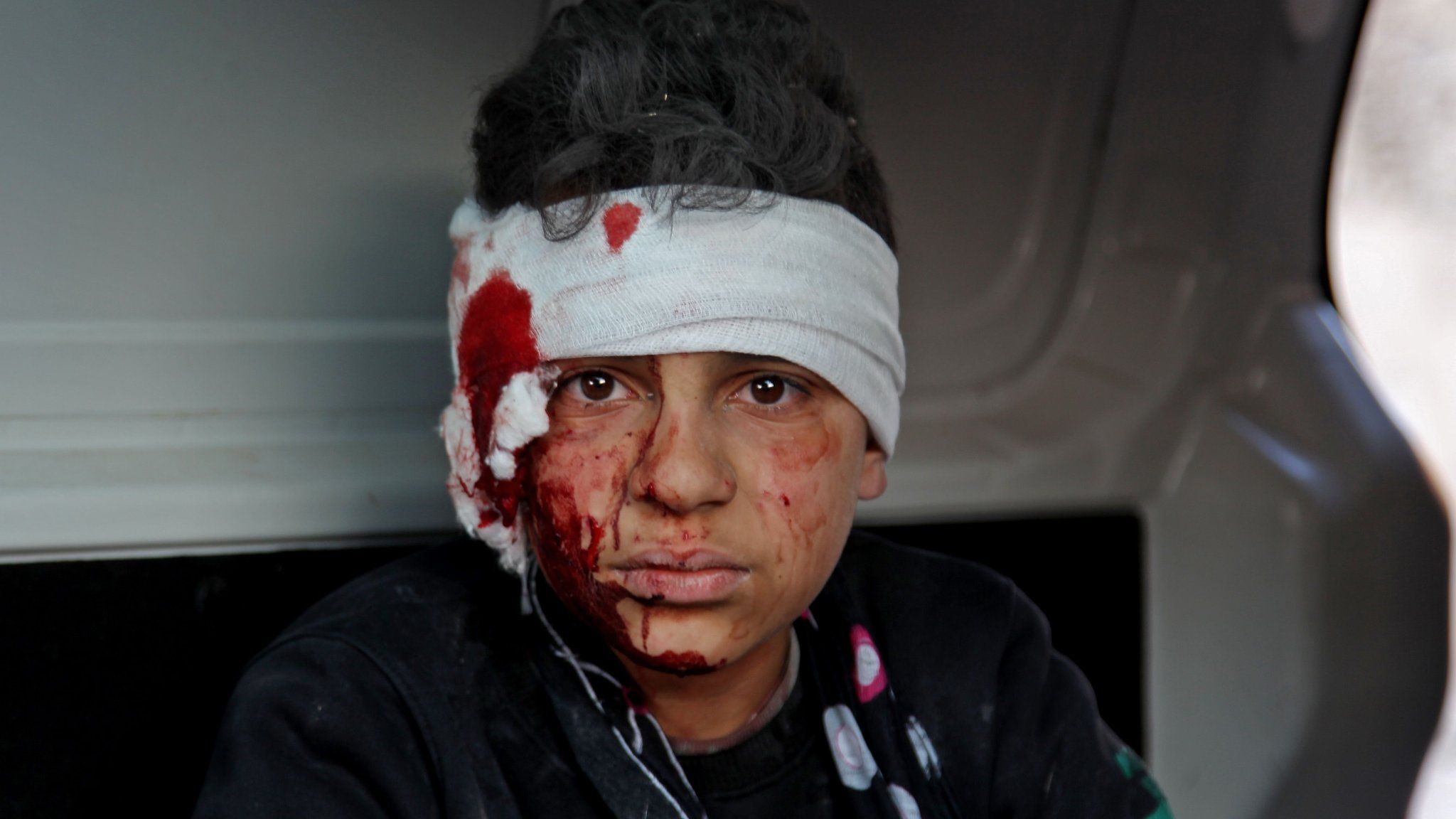 An injured Syrian boy sits inside a vehicle after a reported government air strike in Maarat Misrin, north-western Syria, on 25 February 2020