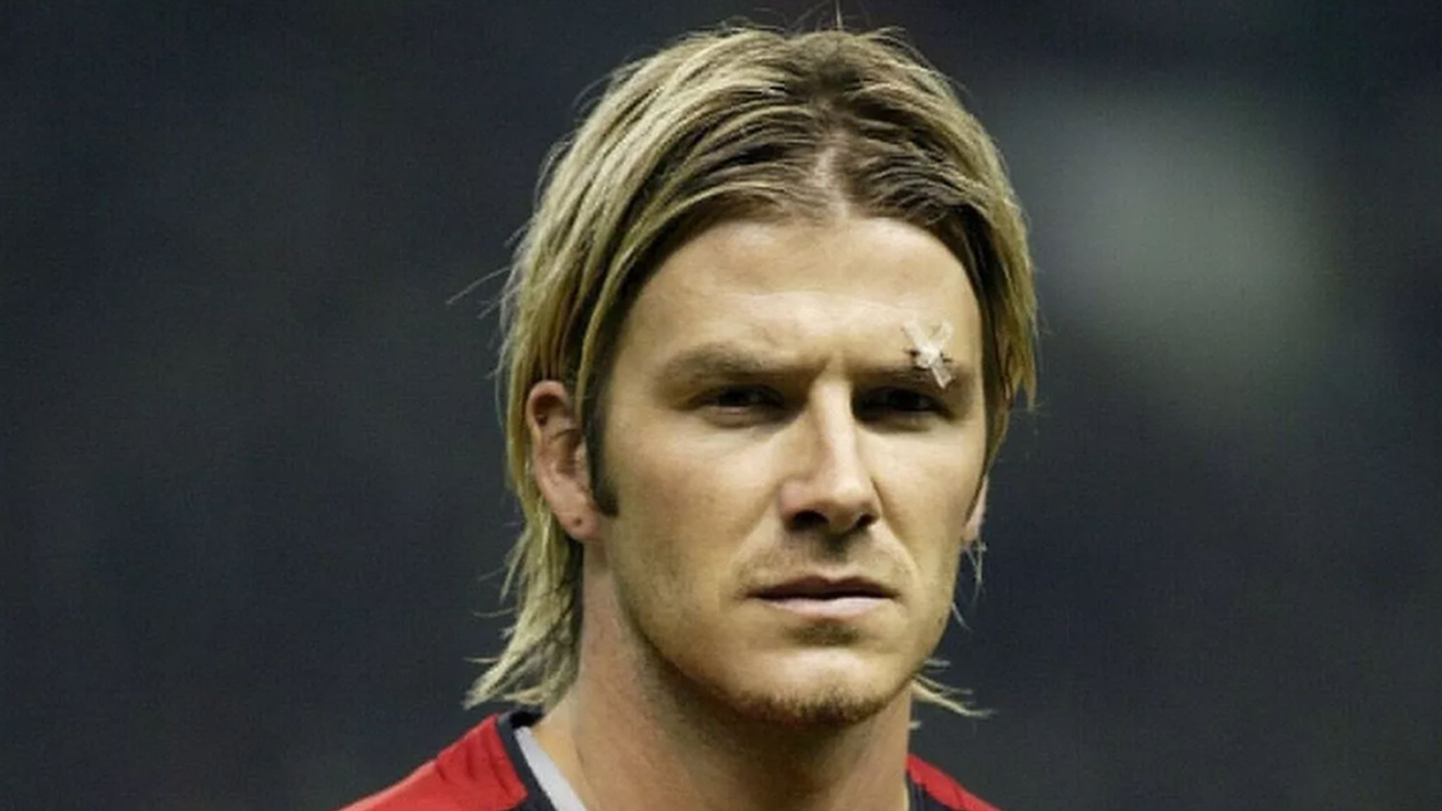 David Beckham with stitches above his eye