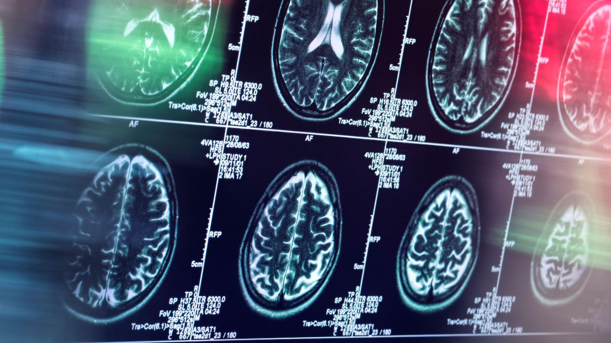 Alzheimer drug - Figure 1