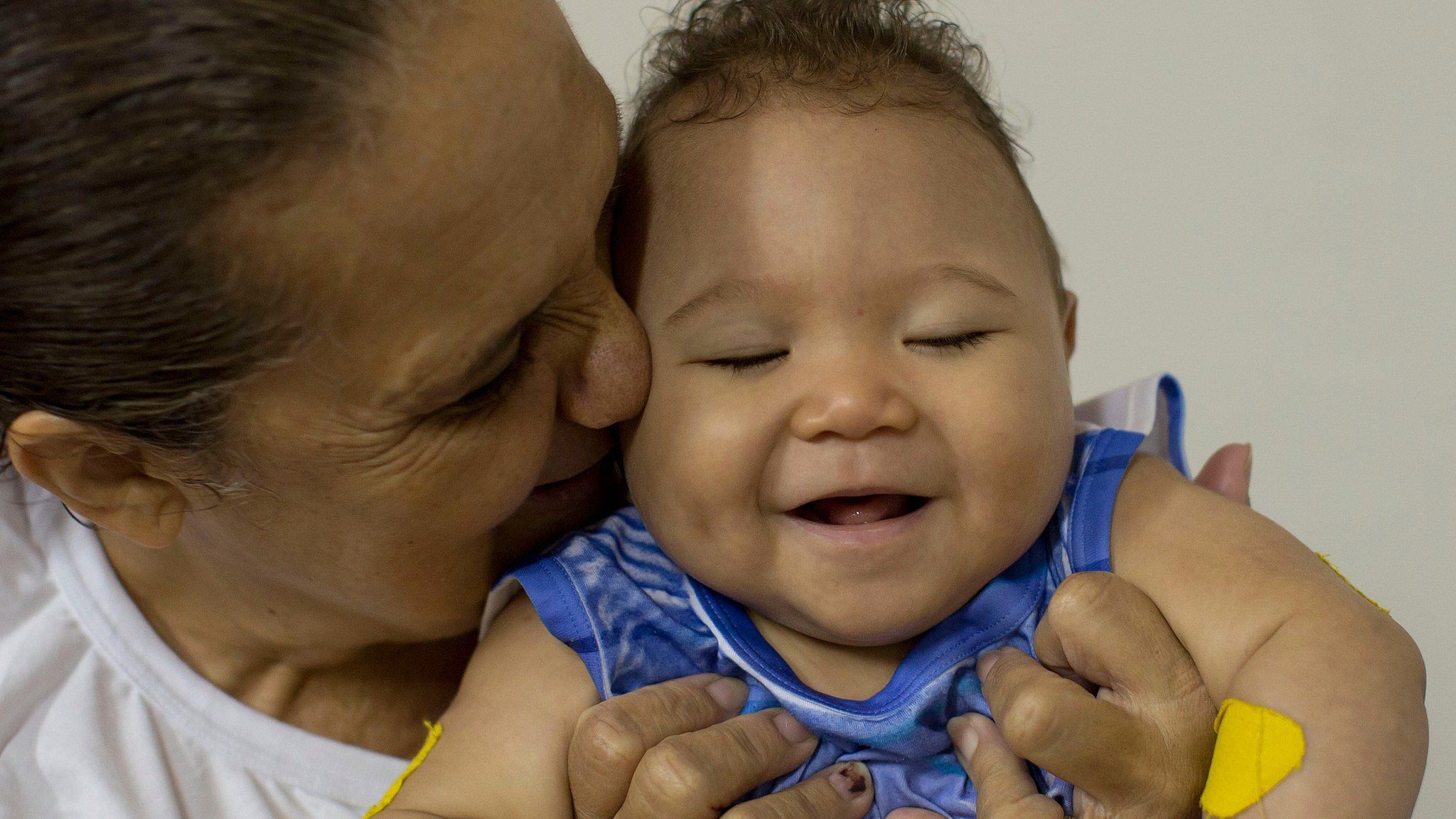 Caio Julio Vasconcelos, who was born with microcephaly, is kissed by a therapist in Joao Pessoa, Brazil, on 25 February 2016
