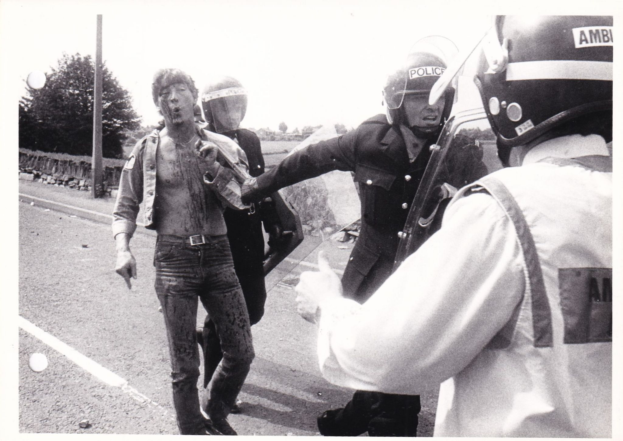 An injured miner is arrested at Orgreave