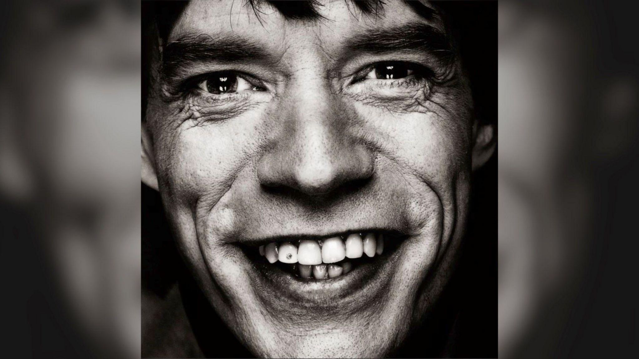 Mick Jagger with a diamond embedded in his tooth