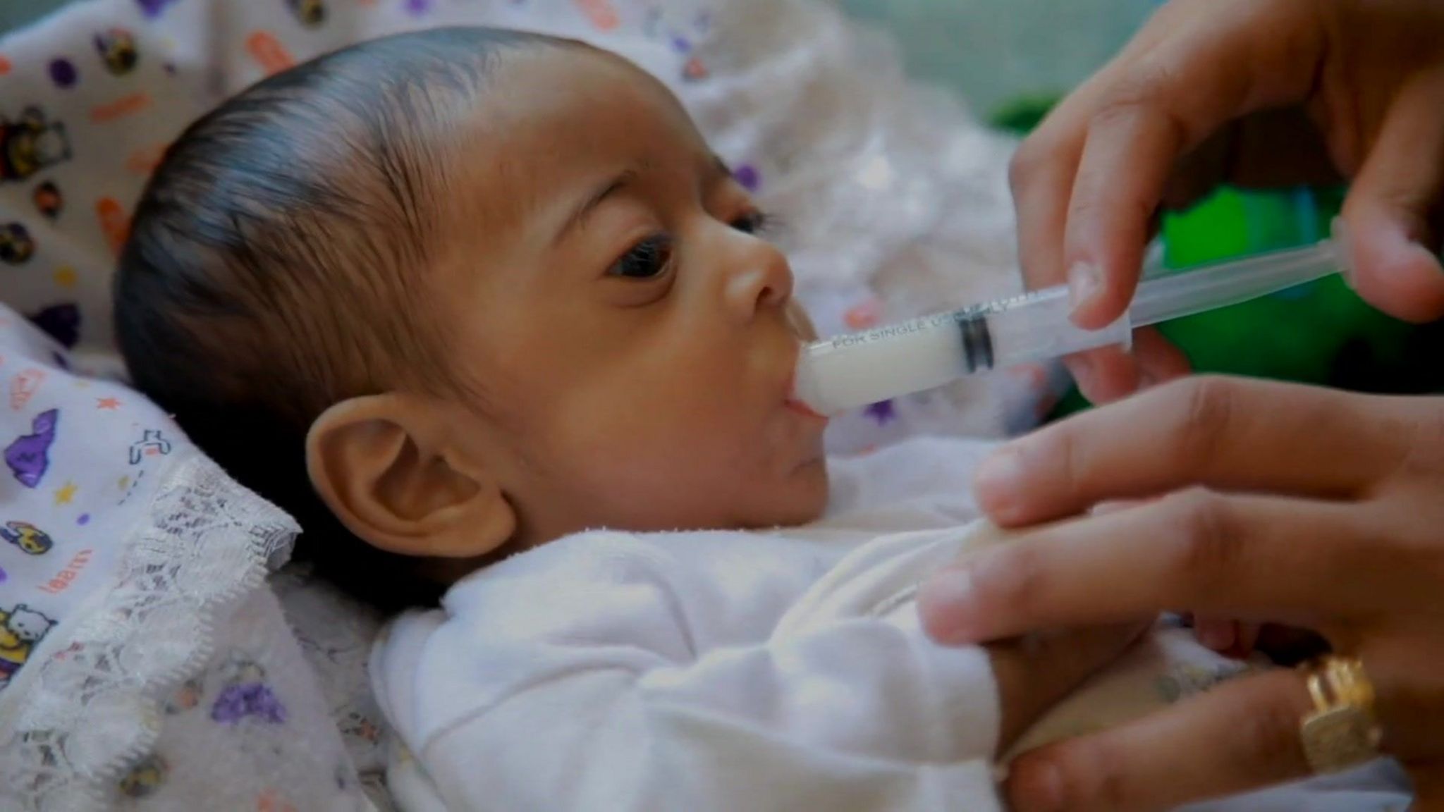 Five-month-old Abdulaziz being fed with a syringe 