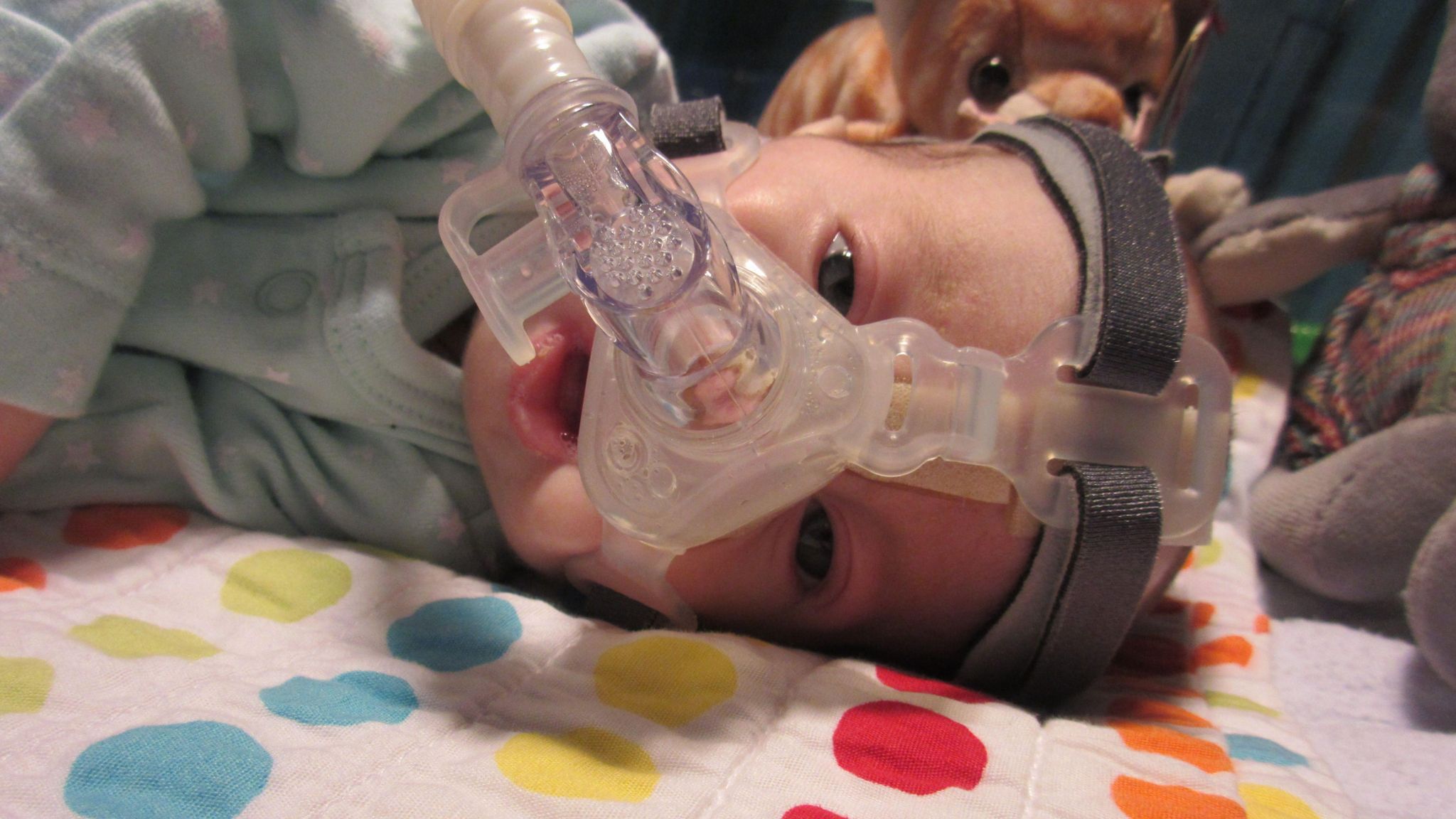 Baby Rumer is wearing a C-Pap machine to help her breathe. She is lying on a hospital cot and has teddies behind her.