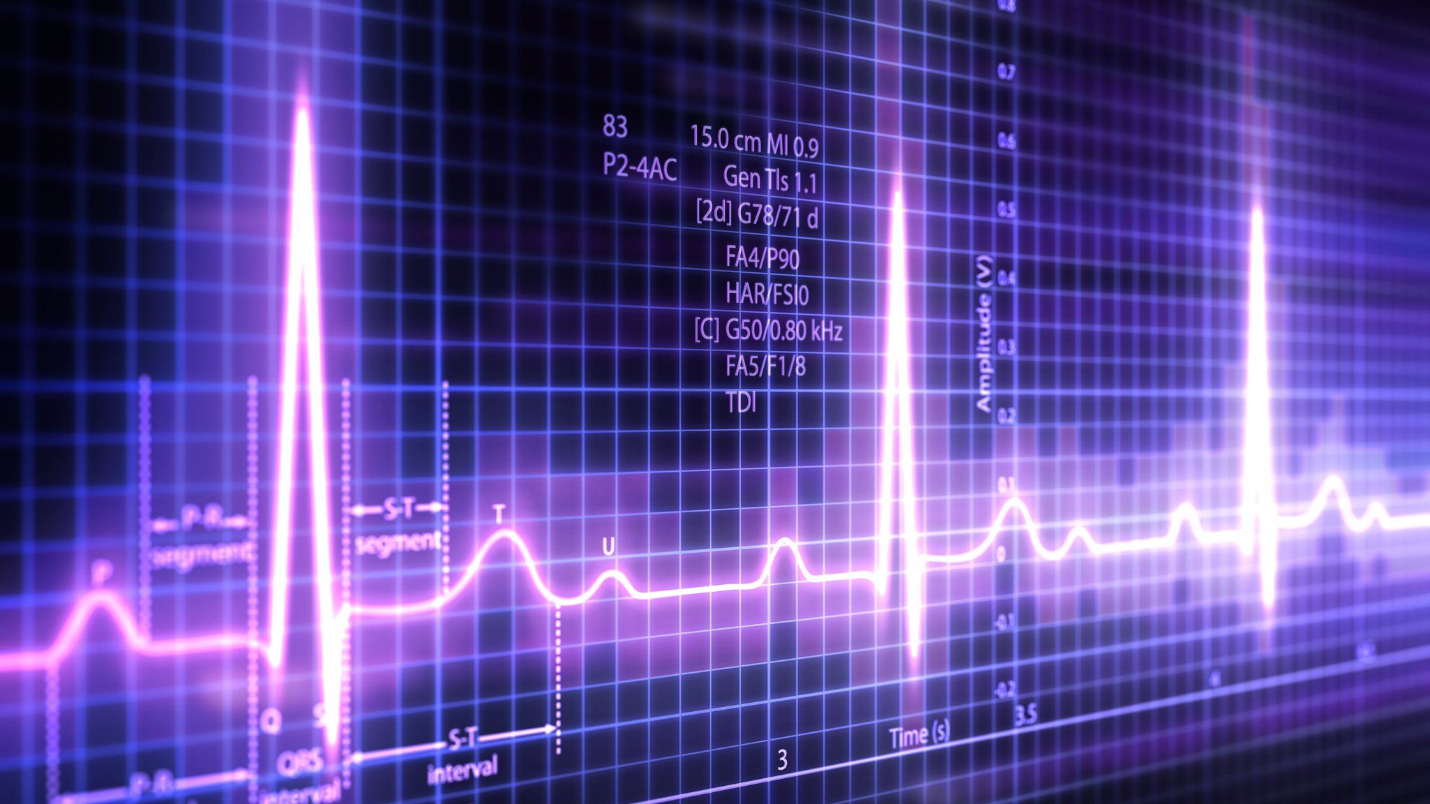 Heartbeat monitor