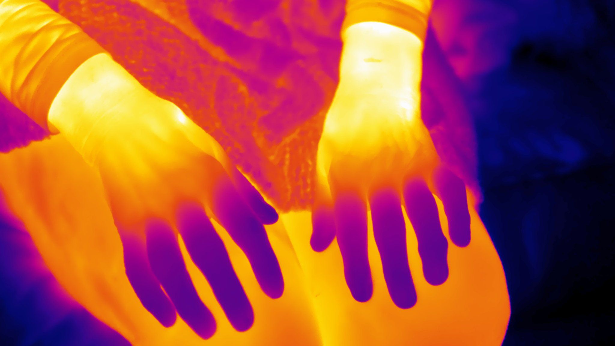 Thermal images of Audrey's hands