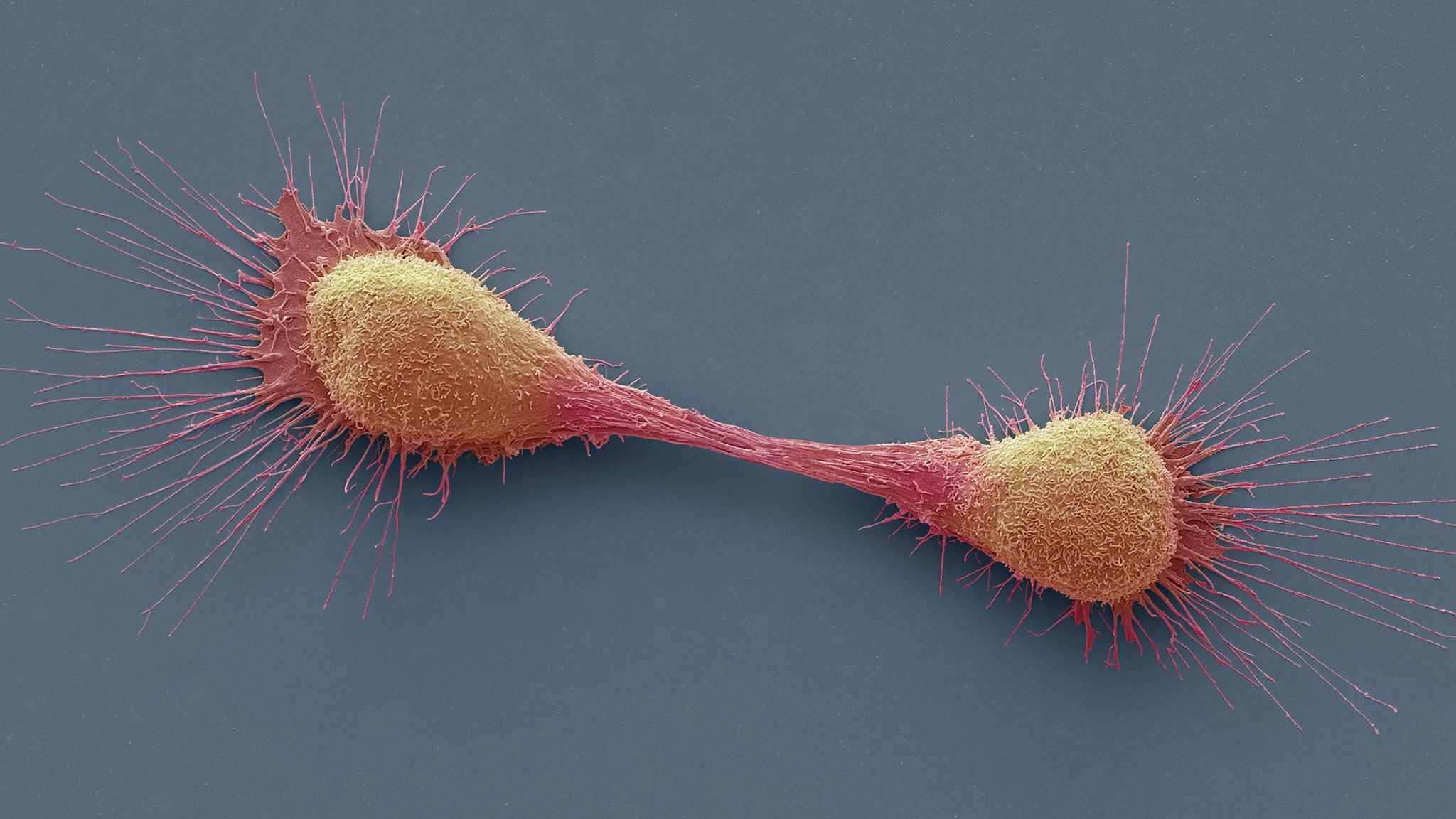 Dividing prostate cancer cells