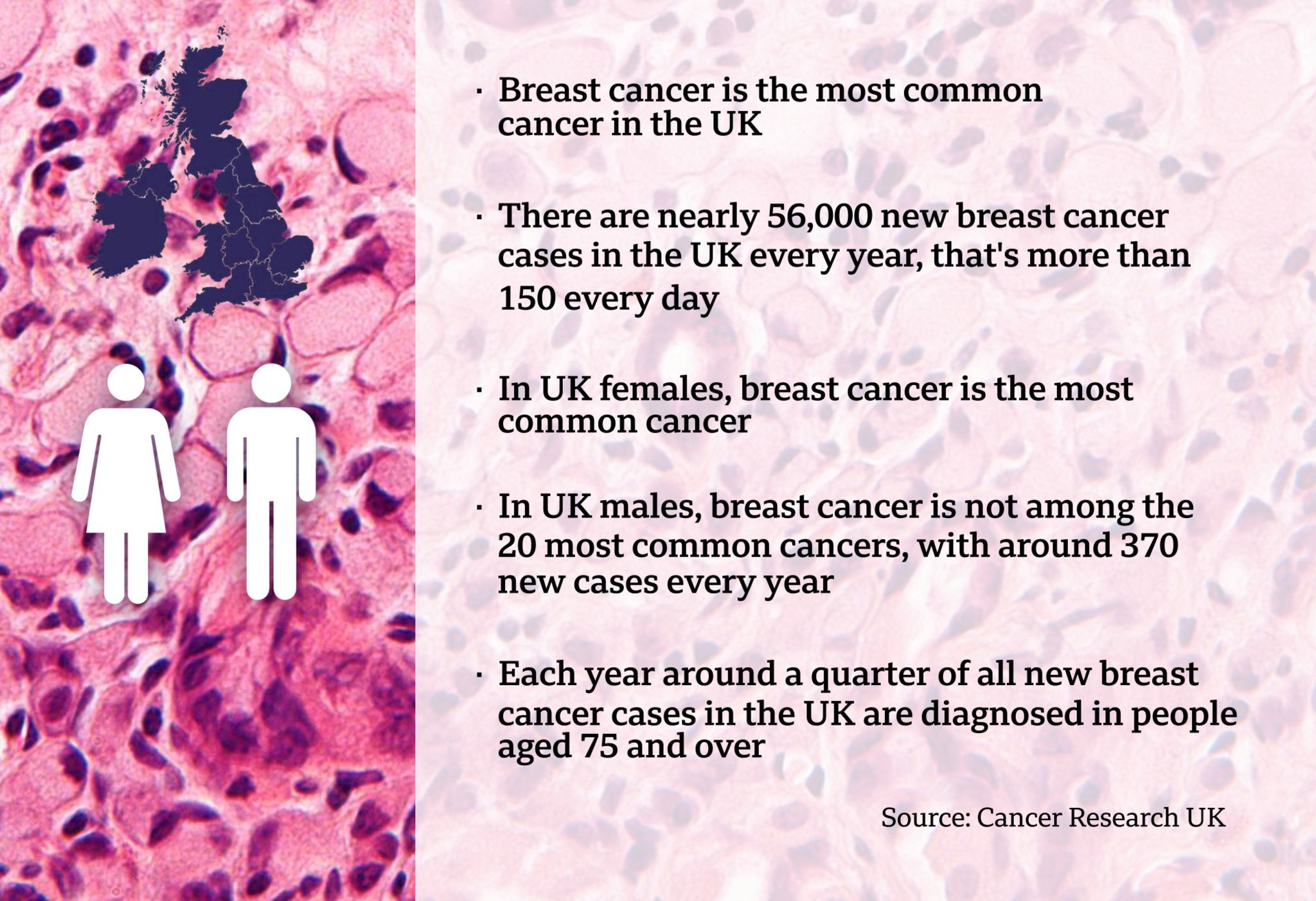 Breast Cancer Many Men Are Oblivious They Can Get Breast Cancer c News