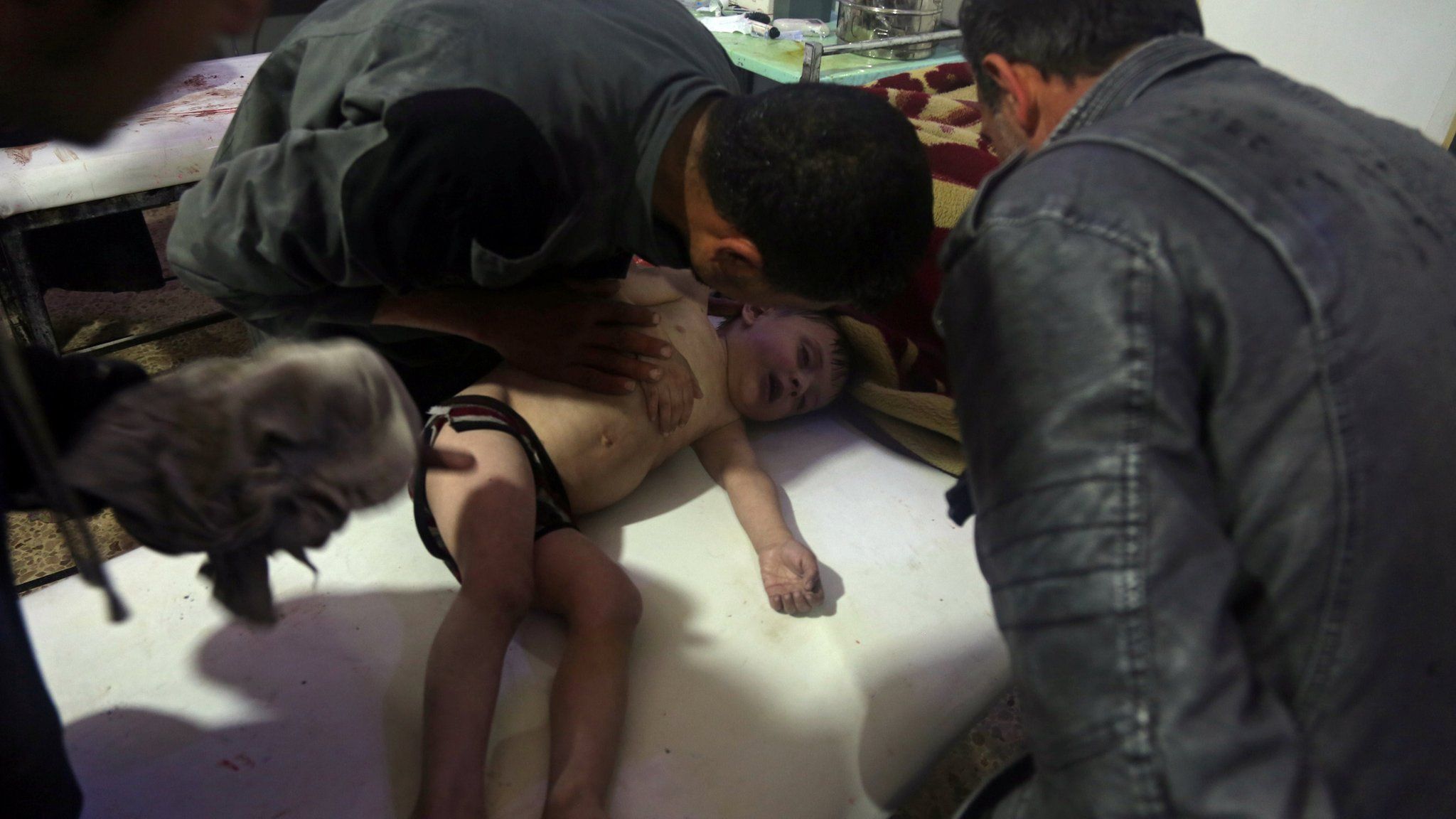 A child is treated in a hospital in Douma, eastern Ghouta in Syria, after what a Syria medical relief group claims was a suspected chemical attack April, 7, 2018.