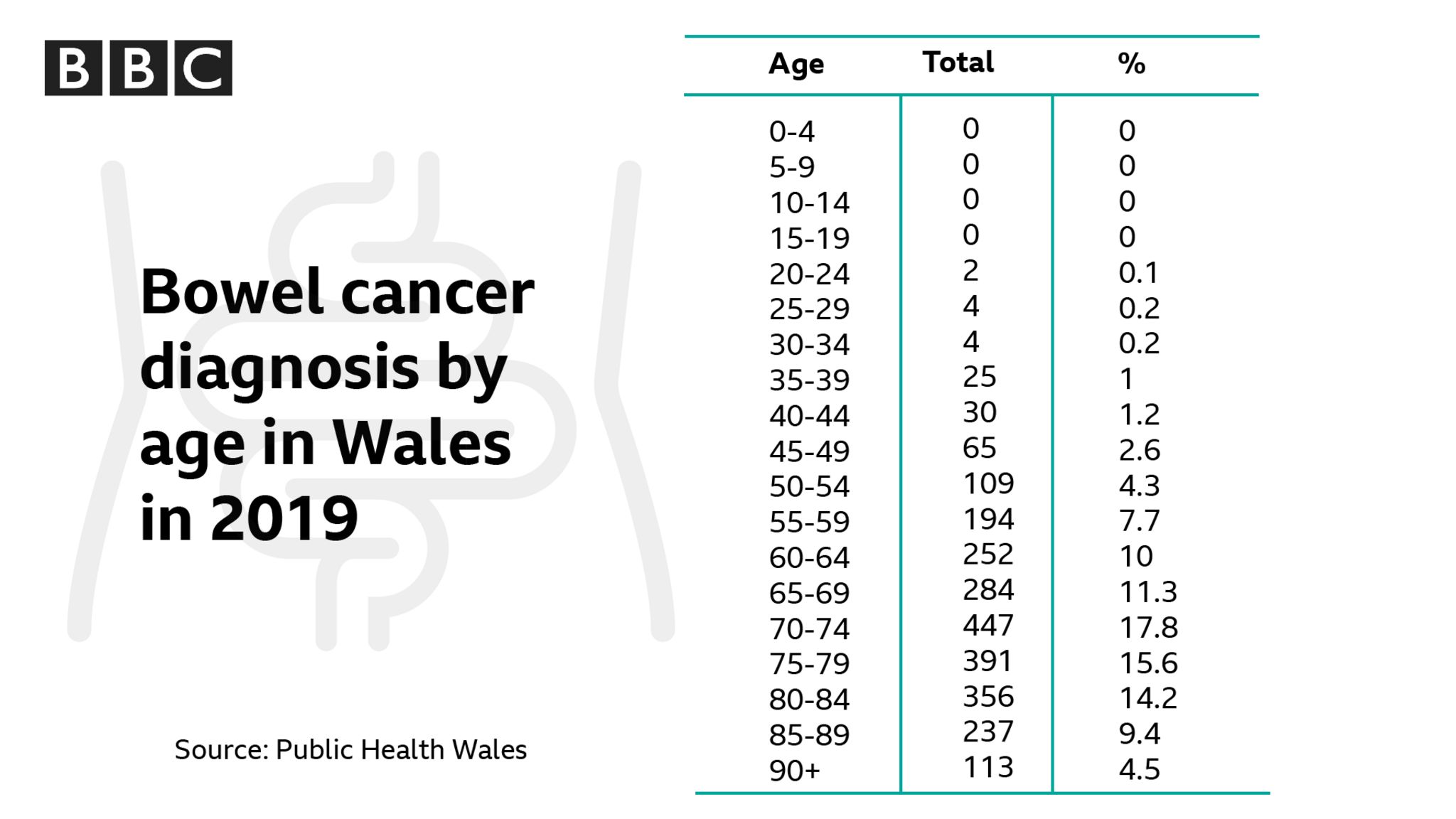 Bowe cancer diagnoses by age