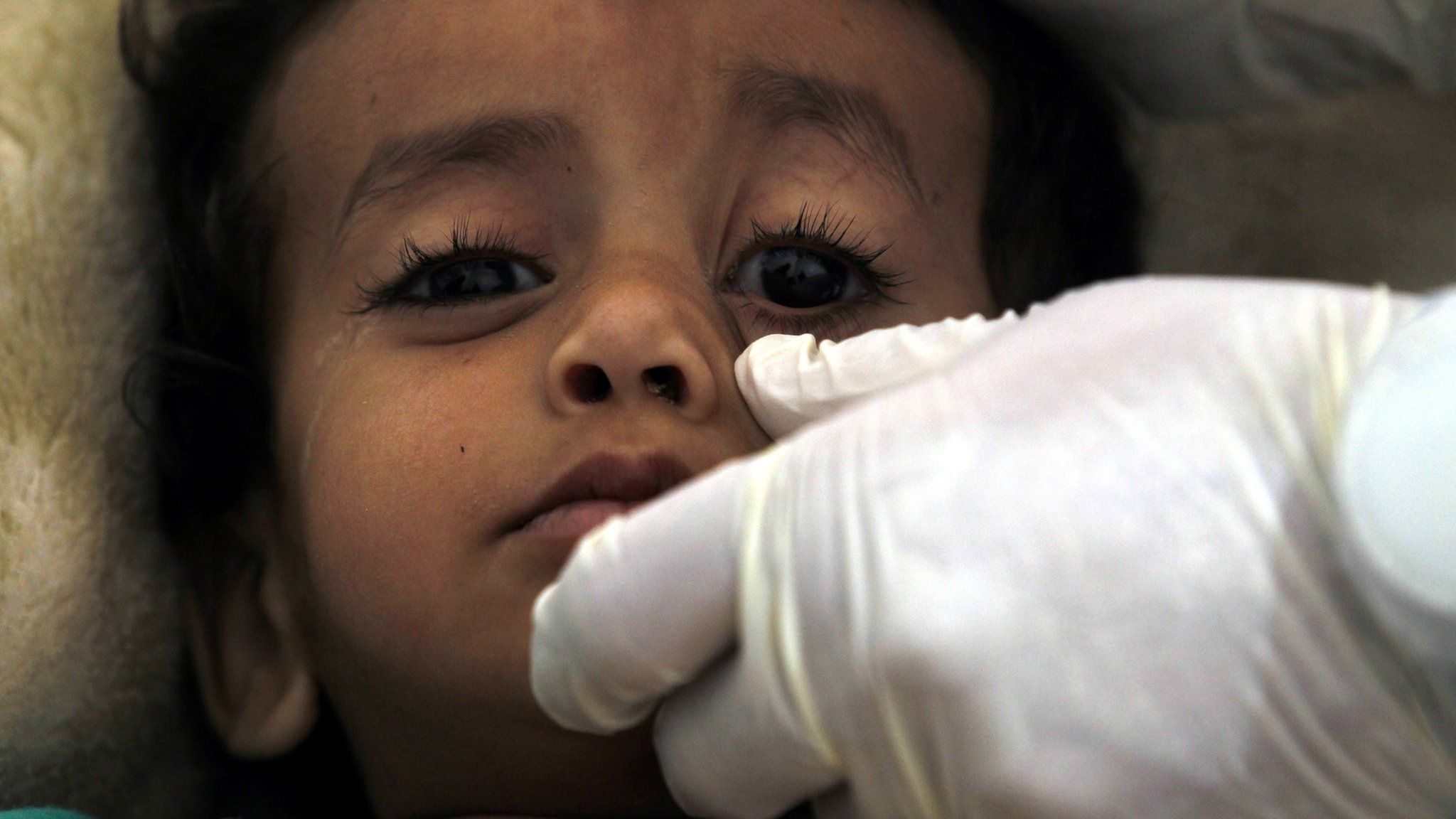 A cholera-infected Yemeni child receives treatment at a hospital amid a serious outbreak in Sanaa, Yemen (4 June 2017)
