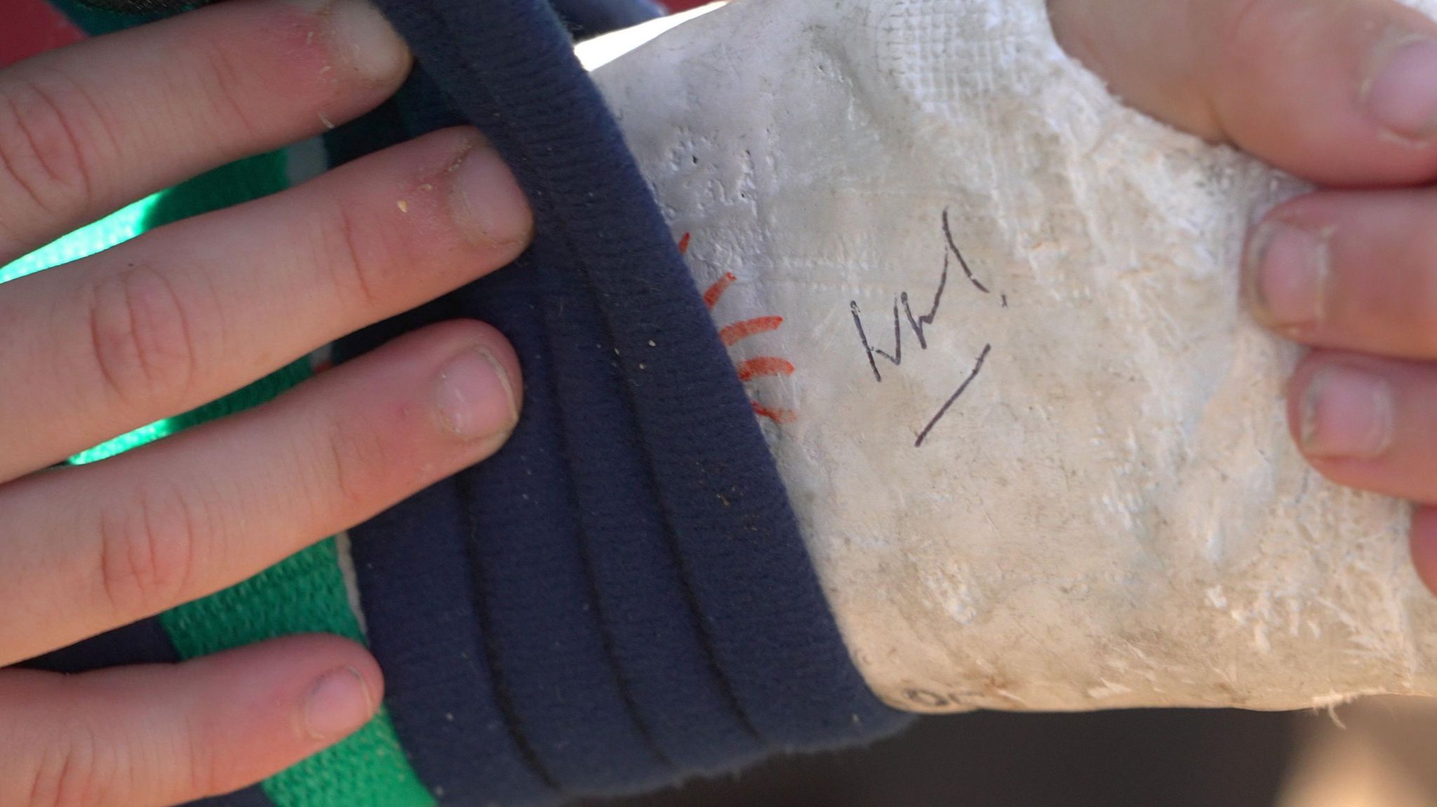 Prince William's signature on a plaster cast