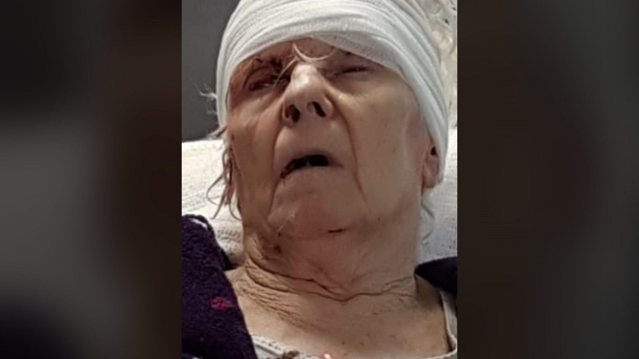 PSNI 'failings' over dementia patient injury investigation BBC News