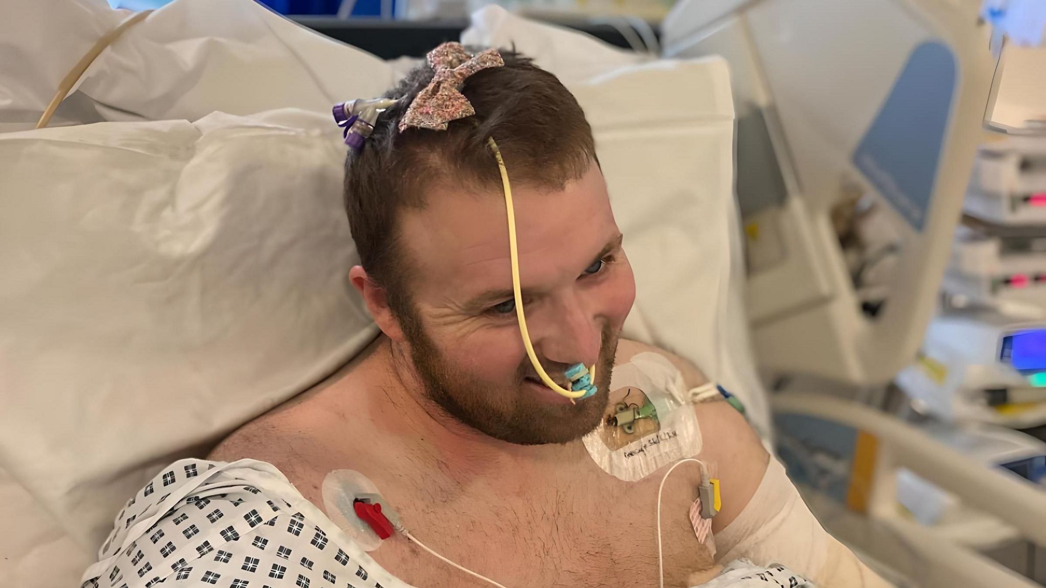 A picture of Jason laughing from his hospital bed at Southmead. The picture is taken from above and shows a bow clipped into his hair on top of medical equipment. 
