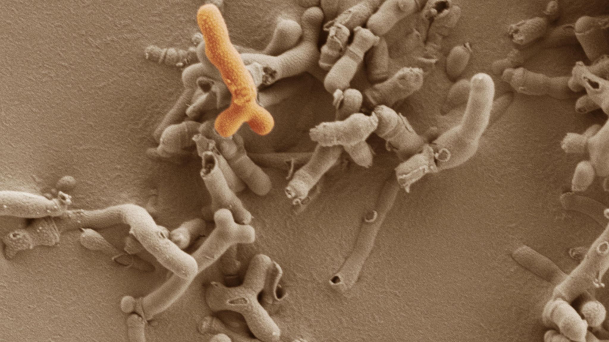 A close up image of Bifidobacterium breve