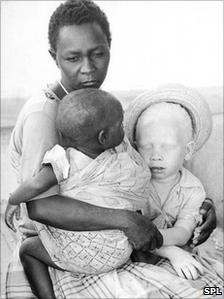 White baby nigerian family has White Baby