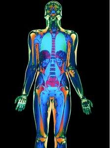 Coloured MRI scan of a man's body