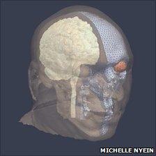 Simulated skull (Michelle Nyein)