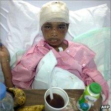 Indonesian maid Sumiati Binti Salan Mustapa, 23, is shown recovering in hospital in Medina in an image released by Indonesian website detik.com on 27 November 2010