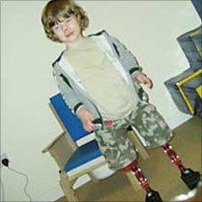 Archie Barton - five-year-old who lost his legs to meningitis