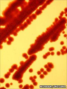 Bacterial cells (Credit: Morran/Indiana)