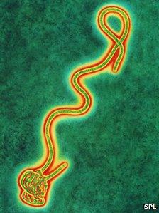 Ebola virus (Credit: SPL)