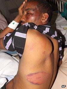 A man lies in hospital with multiple injuries after he says he was beaten by Kenyan troops on Monday 19 November 2012