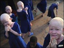 Albino children in a school for the blind in Tanzania