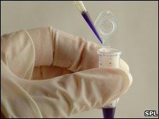 DNA testing in a laboratory