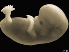Seven week old foetus