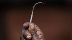 A homemade tool used for female genital mutilation in Uganda