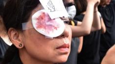 A pro-Hong Kong democracy supporter wears a patch on one eye and a drawing that depicts salt on a wound during a rally in Vancouver