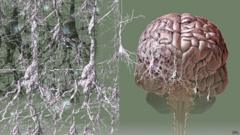 Мозг, пораженный деменцией