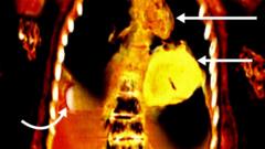 Imagem de tomografia mostra o coração de ouro da múmia