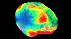 Le scan d'un cerveau