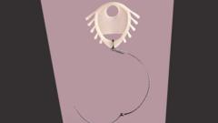 Dispositivo Dalkon Shield