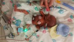 Premature Baby's First Christmas: 'I Didn't Think She'd Survive' - BBC News