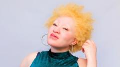 'Pemerkosa saya percaya menyerang orang albino akan melindunginya dari penyakit'