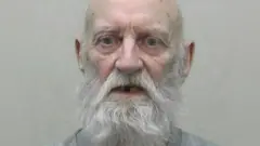Stanley Burnett, a man in his mid-70s. He has a bald head and a long, white beard. His mouth is agape and some of his teeth are missing. His expression appears to be one of concern.