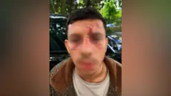 Man with short dark hair. Face visibly injured. Partly blurred