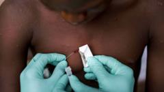 Prueba de la viruela en República del Congo
